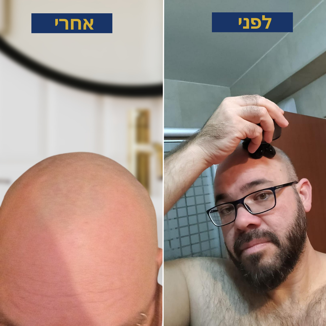 ערכת הגילוח האולטימטיבית לראש (1X להבים + תיק נשיאה) | RAZORJET